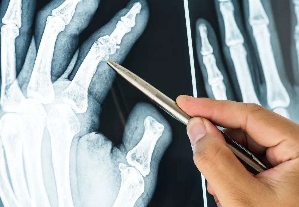 BoneVision AI – Clasificación de radiografías con CNN